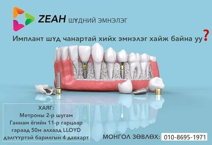 Чэа шүдний эмнэлэг Утас 010-8695-1971 
