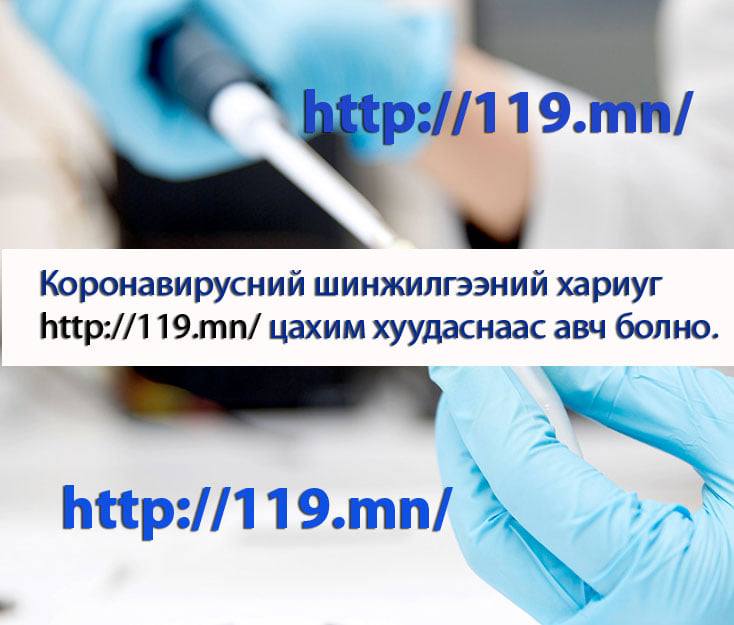 “Ковид-19” халдварын шинжилгээнд 34402 хүн хамрагдаад байна