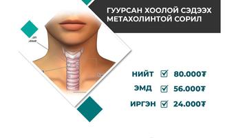 Гуурсан хоолой сэдээх метахолинтой сорилын 30 хувийг иргэн өөрөө хариуцна