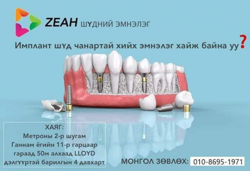 Чэа шүдний эмнэлэг Утас 010-8695-1971 