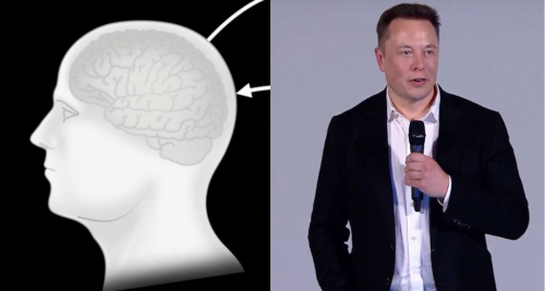 “Neuralink” компани мэдрэлийн гаралтай өвчнүүдийг эмчлэхээр зорьж байна