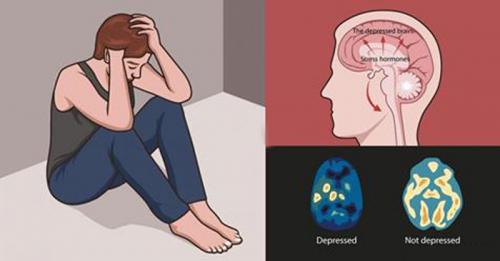 Сэтгэл гутрал яаж мэдрэгддэг вэ?