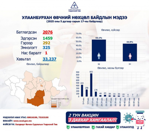 ХӨСҮТ: Улаанбурхан өвчний лабораториор батлагдсан тохиолдол 2076 болжээ
